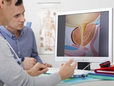 A urologist consults a patient about potency problems